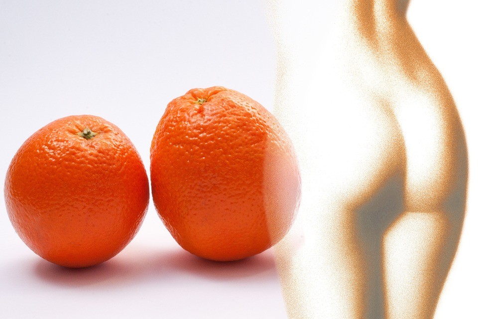 Cos'è la cellulite