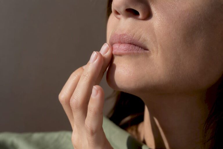 Rughe verticali attorno al labbro superiore